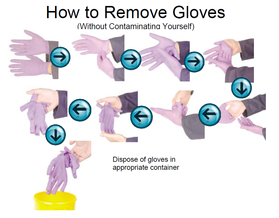 how to remove gloves without contaminating yourself