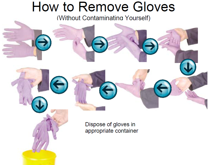 Gloves